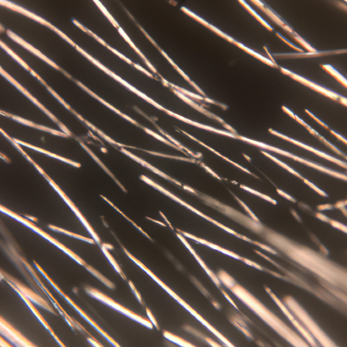 zinc-whiskers-2 Microscopic image of zinc whiskers